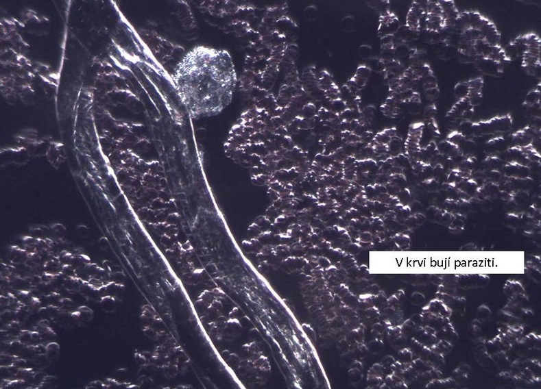 negi genitale la bărbații din uretra papilloma development tumor